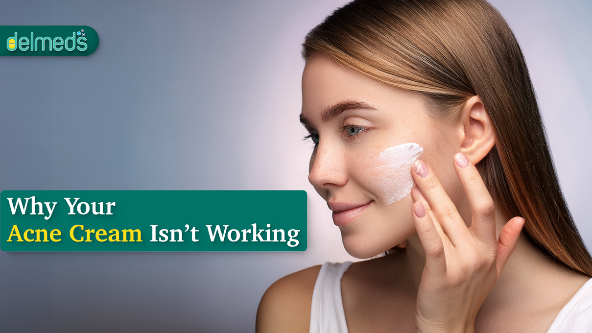 Why Your Acne Cream Isn’t Working (And What To Do Instead)