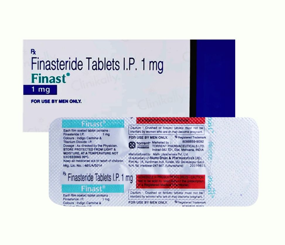 Finast 1mg Tablet